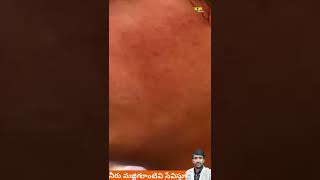మనషక తల కటటగన ఏమ జరగతద