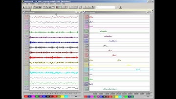 Signal Processing chapter 08 Classical modulation