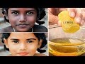 Face Whitening Home Remedies Lemon, Honey and Tomato Facial