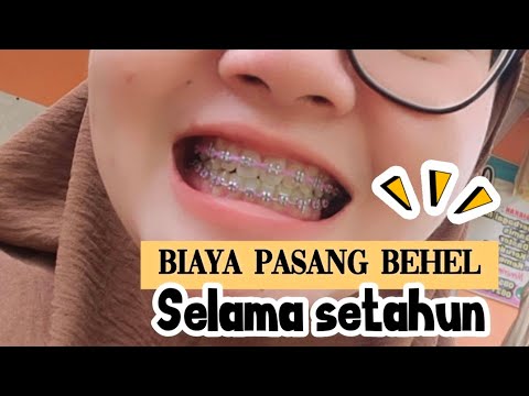 SETAHUN PAKAI BEHEL LANGSUNG RAPI / BIAYA PASANG BEHEL DI DOKTER SPC ORTHO