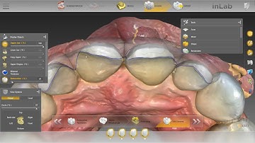 5 "BREAD & BUTTER" Cases: A look at daily work