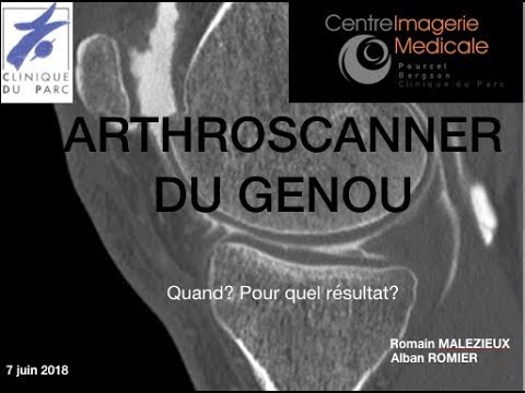 Arthroscanner du genou- Alban ROMIER