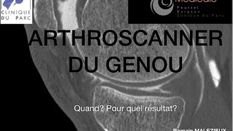 Pourquoi un scanner du genou ?