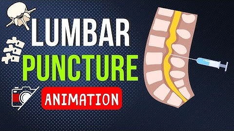 🎬 LUMBAR PUNCTURE (LP) | SPINAL TAP | TECHNIQUE | ANATOMY | SAMPLE | ANIMATION