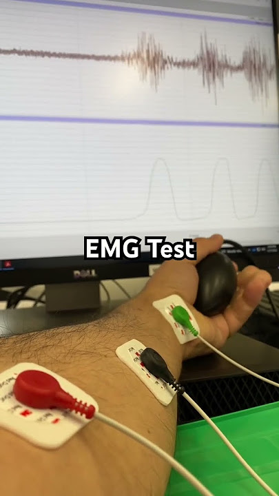 EMG: Measuring Muscle Activity and Grip Strength with the iWorx Data Acquisition System