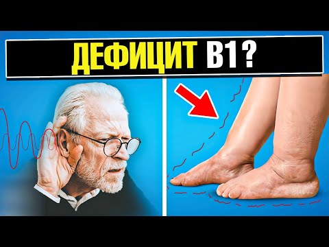 Видео: Главные симптомы дефицита витамина В1: причины, последствия👀