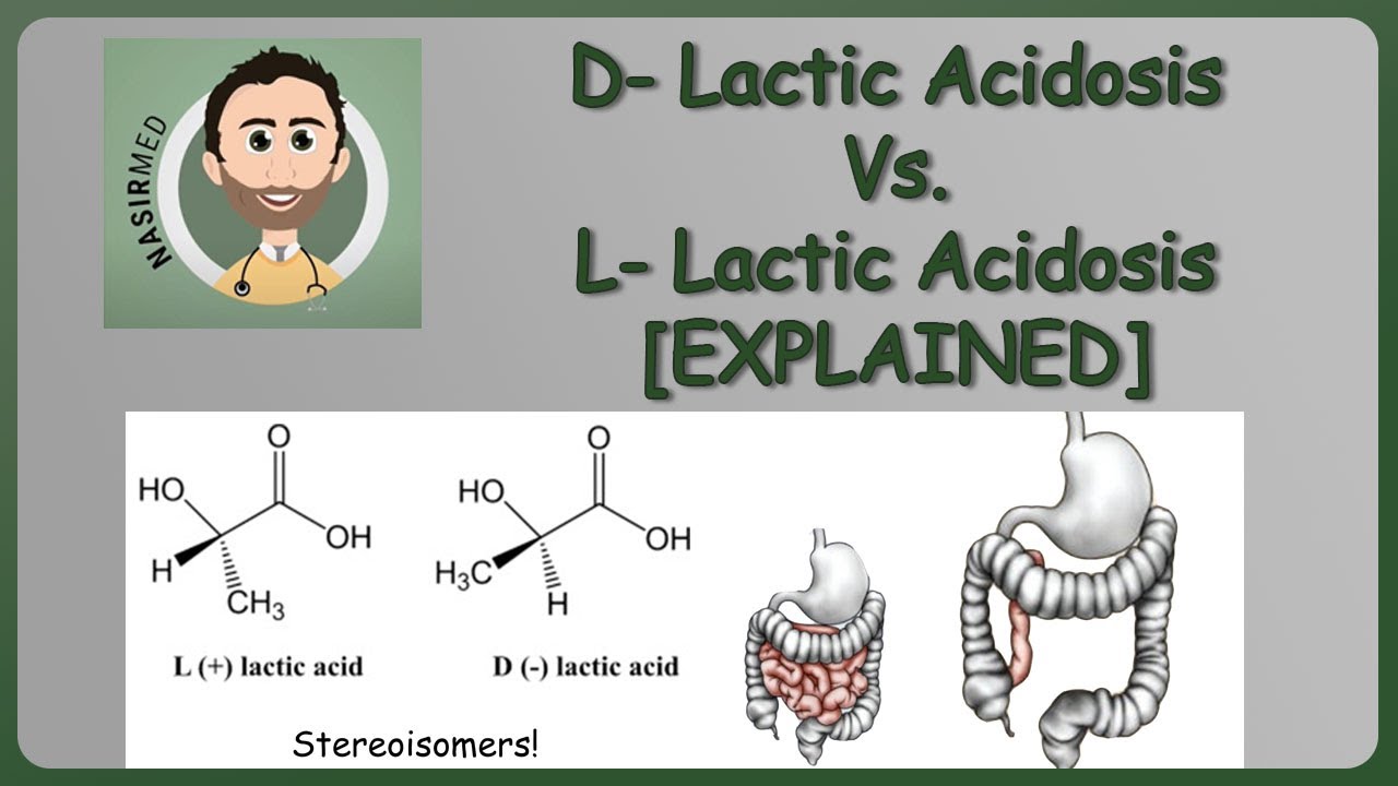 D Lactic Acidosis Vs L Lactic Acidosis Explained Nyk Series