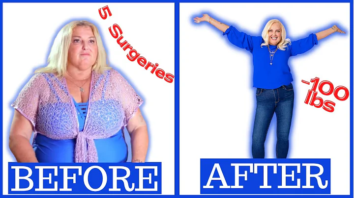 90 Day Fiance's Angela Lost 100 Pounds, Had 5 Surg...