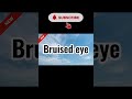 KaTa Studio Official Bruised eye. #music #love #dance #newmusic #pop #motivation #new  #dj #remix