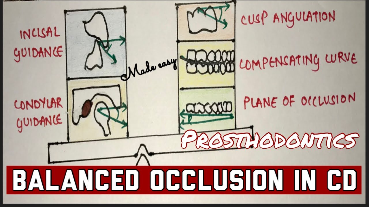 BALANCED OCCLUSION IN COMPLETE DENTURE made easy YouTube