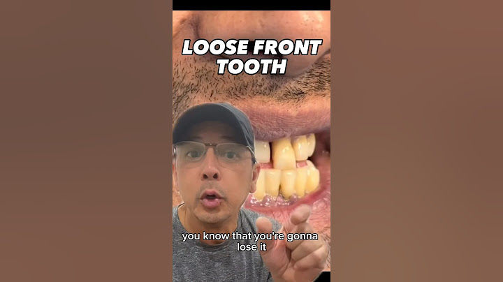 What to Do If You Have a Loose Front Tooth | In Office to Hands On Dental Training #shorts