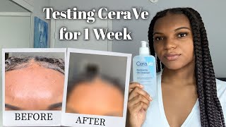 CERAVE RENEWING SA CLEANSER REVIEW | I Tried CeraVE for 1 Week