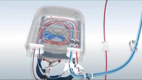 Priming of the HLS Set (CardioHelp)