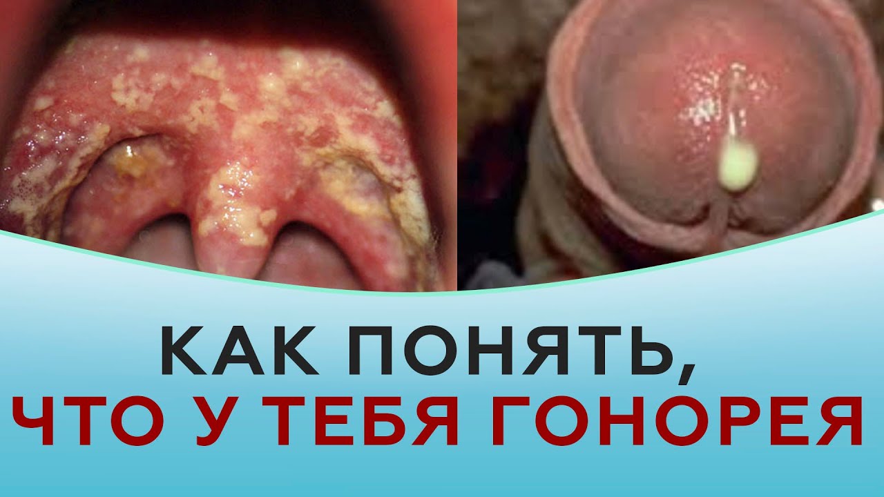 Ерлердің аузына камминг жасайтын әйелдердің порносын көріңіз Үндістанның мүшесі кино