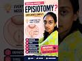 Episiotomy Important Exam Questions for NORCET#Episiotomy #NormalDelivery #LaborRoom #Obstetrics #yt