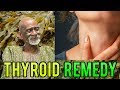 Dr Sebi - Natural Herbal Remedy For Enlarged Thyroid