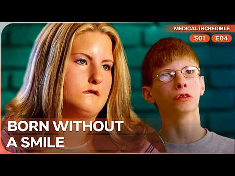 The Great Dilemma of the Moebius Syndrome | Medical Incredible