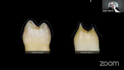 👇👇ESTHETICSr/ Javier Tapia GuadixThe Bio- Emulation approach to Direct Composite