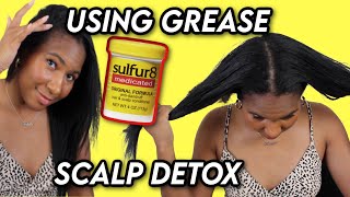 HOW I USE SULFUR 8 GREASE TO GET RID OF DANDRUFF