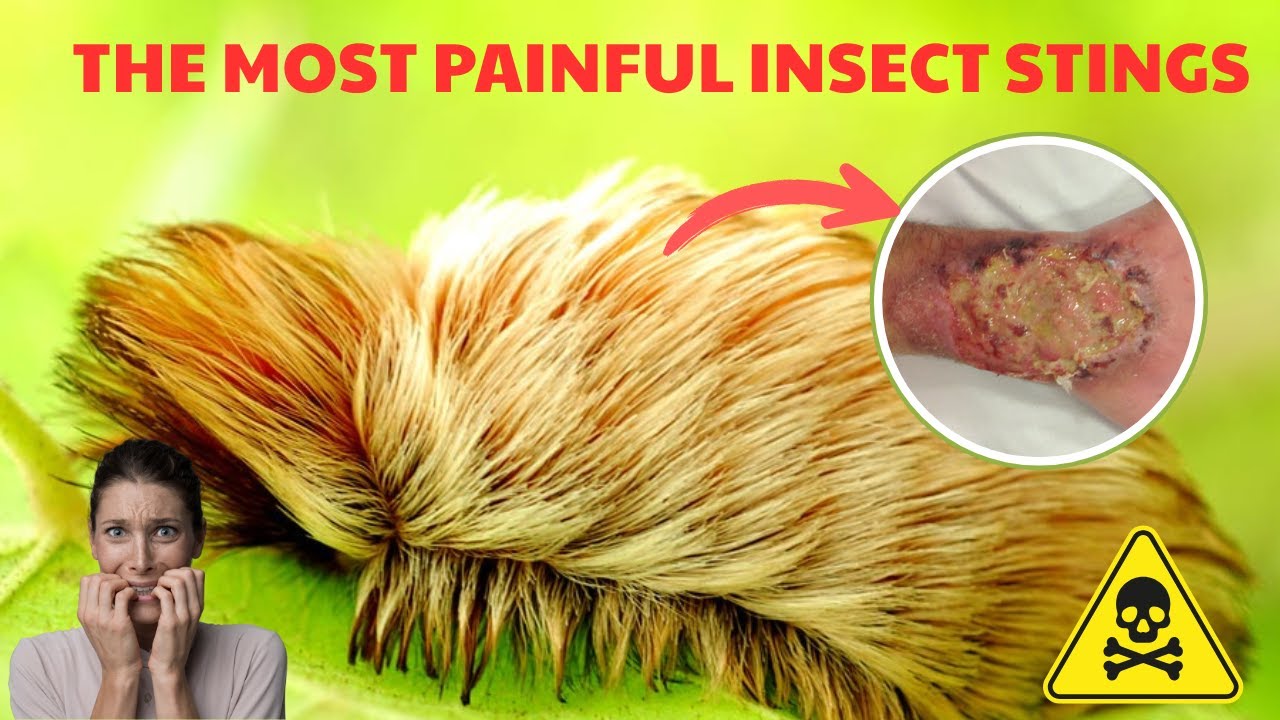 Worst INSECT Stings You Never Knew Existed - YouTube