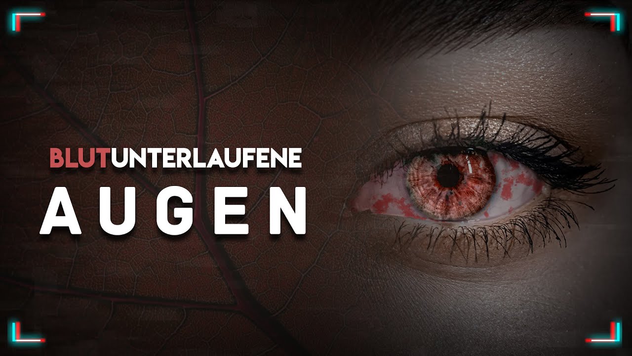 Creepypasta German - &amp;quot;Blutunterlaufene Augen&amp;quot; // Albtraumarchiv - YouTube