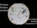 Life in a drop of water from a puddle. Episode 036b - Protozoa Rotifera ... pooping?