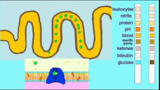 URINALYSIS: GLUCOSE AND KETONES