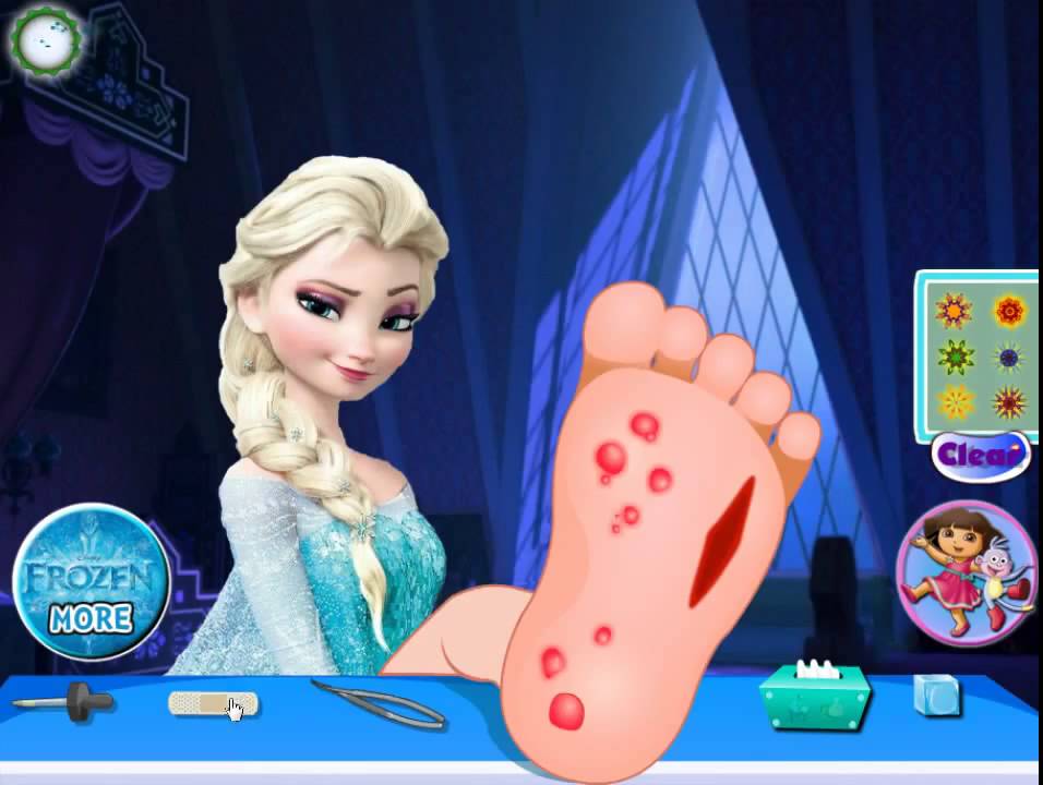 Elsa foot