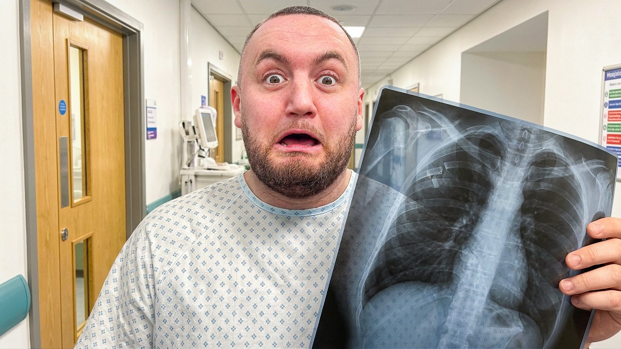 I Have Broken My Rib?!
