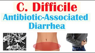 Clostridium Difficile (AntibioticAssociated Diarrhea) Risk Factors, Symptoms, Diagnosis, Treatment