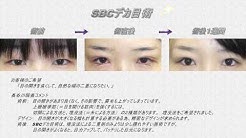 美乳豊胸 脂肪吸引 二重埋没法 湘南美容外科 銀座院 美容整形 長谷川院長 Youtube