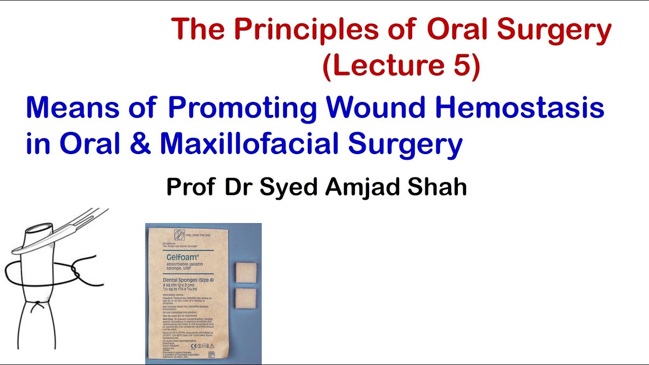 Means of Promoting Wound Hemostasis in Oral & Maxillofacial Surgery