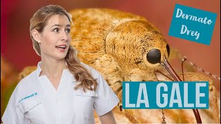 La gale ! Tout ce qu'il faut savoir pour s'en débarrasser ! #DermatoDrey Resimi