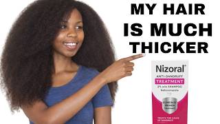 My Hair Got Damaged: PART 3 (Did Nizarol Help Grow My 4C Hair?)