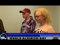 EMBRACE DIVERSITY, CELEBRATE UNIQUENESS. HAPPY WORLD ALBINISM DAY.
