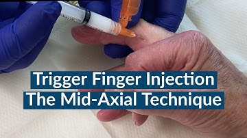 Trigger Finger Injection : The Mid-Axial Approach