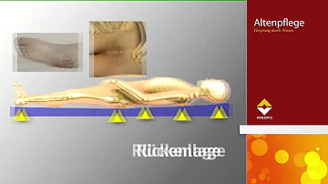 Welche Körperstellen sind besonders Dekubitusgefährdet und warum?