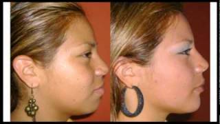 Armonia facial ortodoncia dr josue garcia lalo