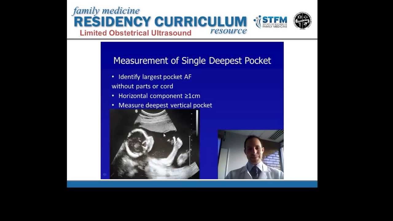 Amniotic Fluid Index Lecture.mp4 - YouTube