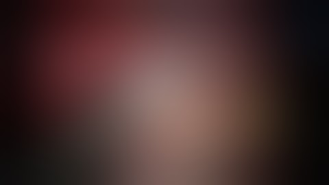 Robotic partial hepatectomy of HCC located between S7-8