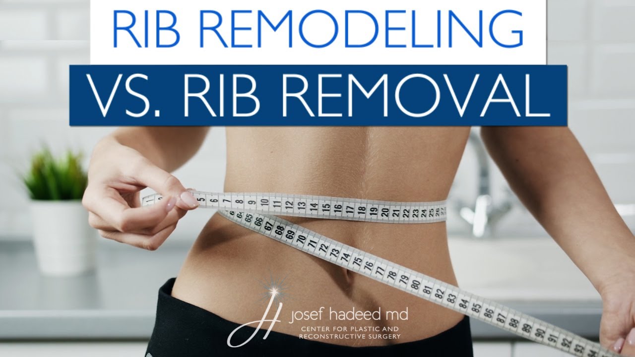Rib Remodeling vs Rib Removal - YouTube