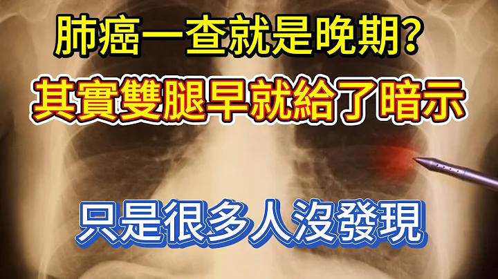 肺癌一查就是晚期？其實雙腿早就給了暗示，只是很多人沒發現 - 天天要聞