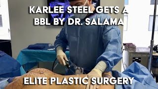 Karlee Steel BBL Surgery | Elite Plastic Surgery