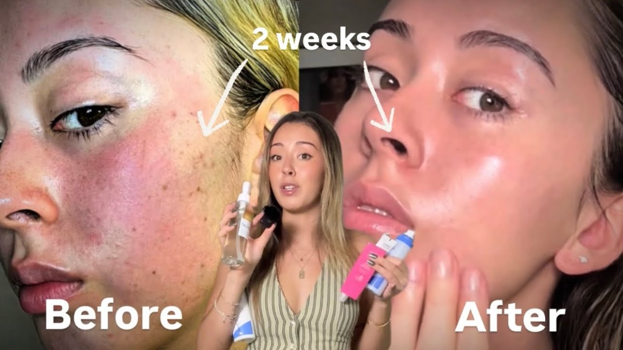 Как ВОССТАНОВИТЬ КОЖНЫЙ БАРЬЕР | признаки его повреждения + уход за кожей *за 6 минут*