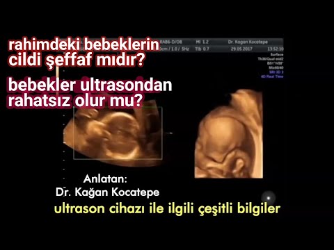 Anne karnındaki bebeğin cildi şeffaf mıdır?, bebek ultrason yapılırken ışıktan rahatsız olur mu?