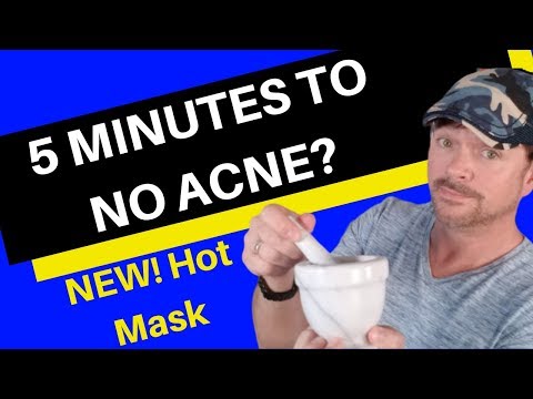 5 Minute Hot Mask For Acne | CHRIS GIBSON