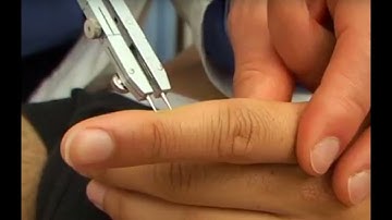 Tweepuntsdiscriminatie - Grafesthesie - Stereognose