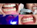 ADD TEETH WHITENING TO YOUR BEAUTY SERVICES | BELINDA ALMA