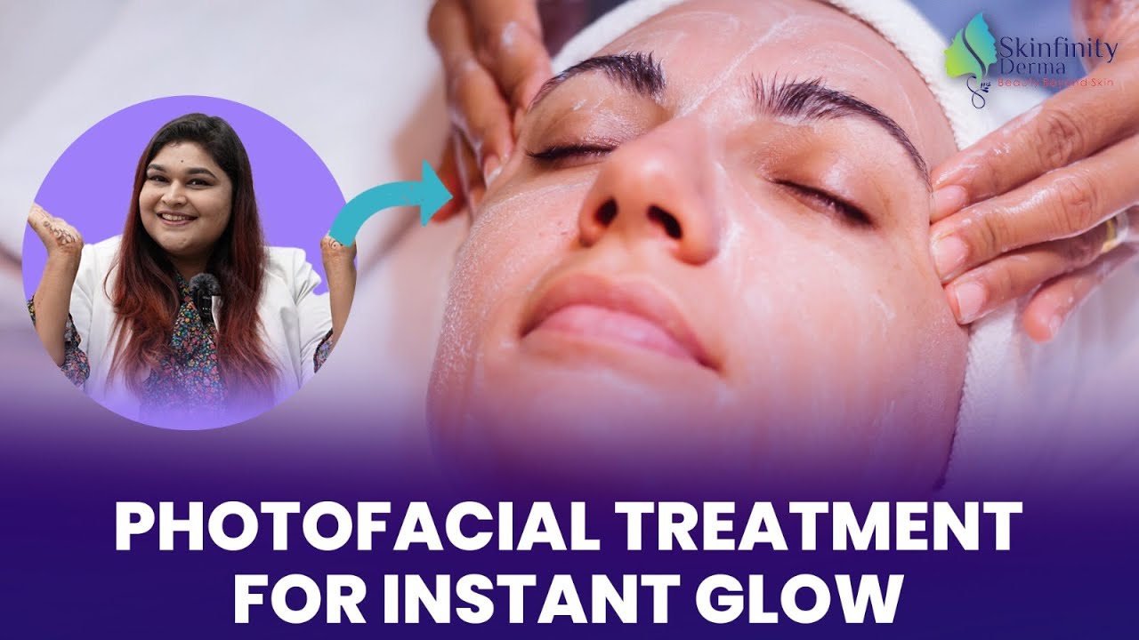 Photofacial Treatment Procedure For Instant Skin Glow | Photofacial Treatment for Skin Lightening