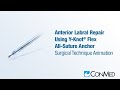 Anterior labral repair using the yknot flex  conmed animation